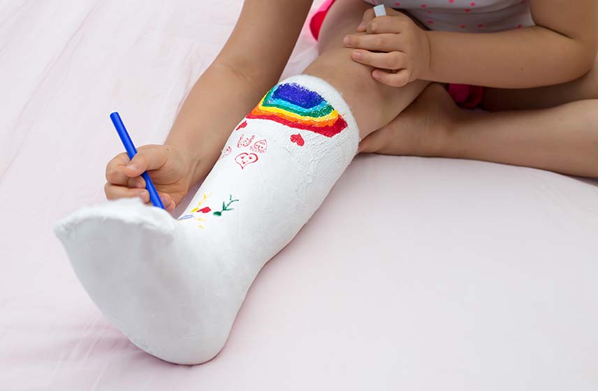 Child patient drawing art on lower leg cast.