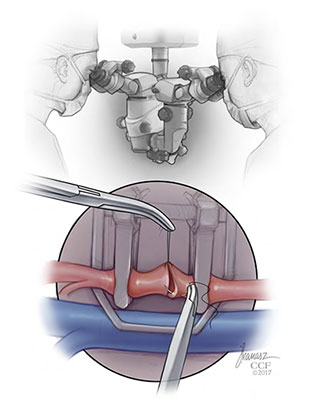 Microsurgery Training Courses | Cleveland Clinic