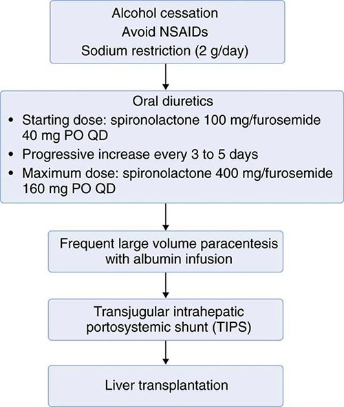 Treatment options for cirrhotic ascites | Cleveland Clinic