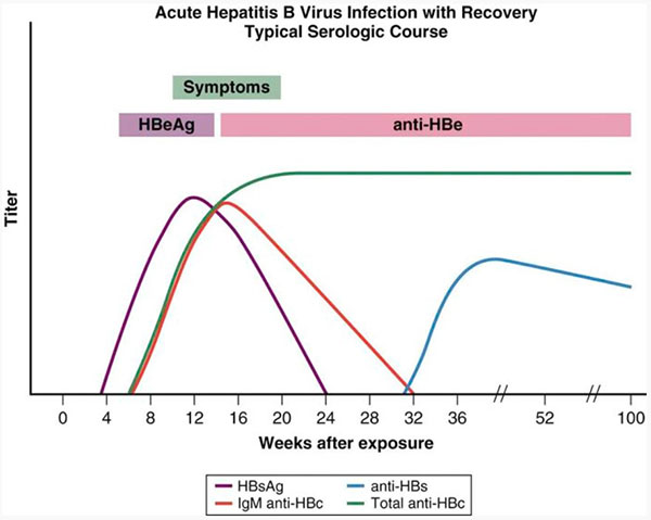 Figure 1: Acute Hepatitis B Virus Infection with Recovery - Typical Serologic Course