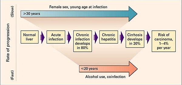 Figure 1: Hepatitis C - Rate of Progress