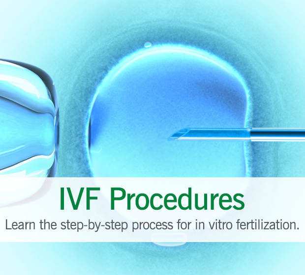 IVF Procedures | Cleveland Clinic