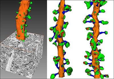 Dendritic Spines | Cleveland Clinic