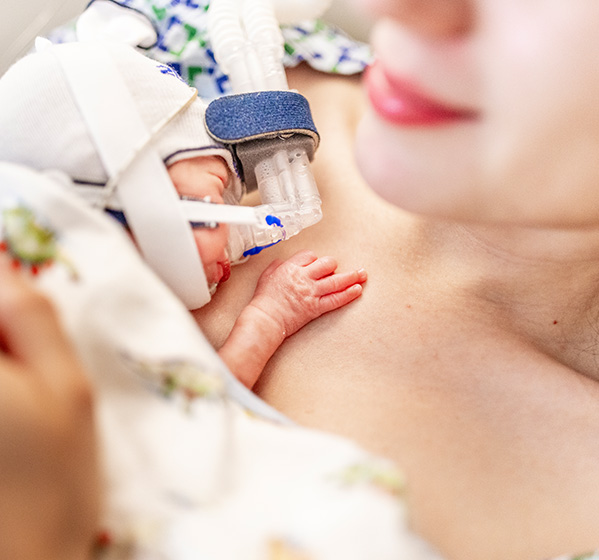 woman with premature infant