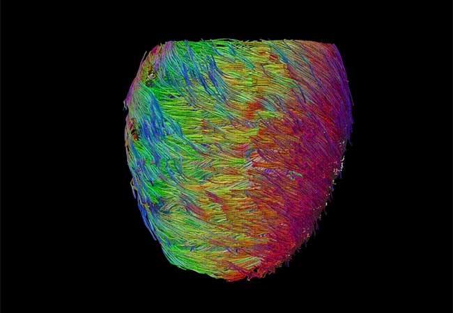 Heart MRI image