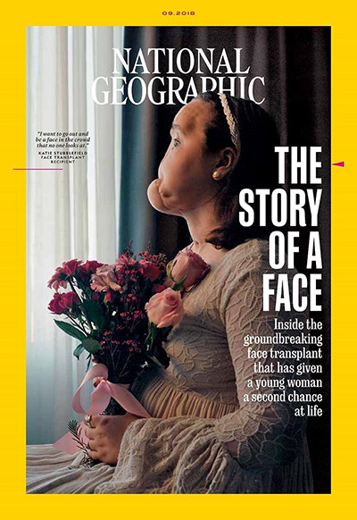 National Geographic Cover for The Story of a Face | Cleveland Clinic