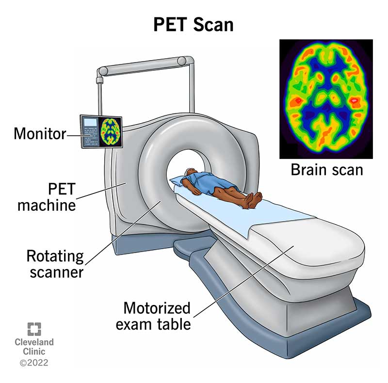 Illustration of a PET scan machine, which has a donut-shaped hole that your body passes through while laying on a motorized exam table.