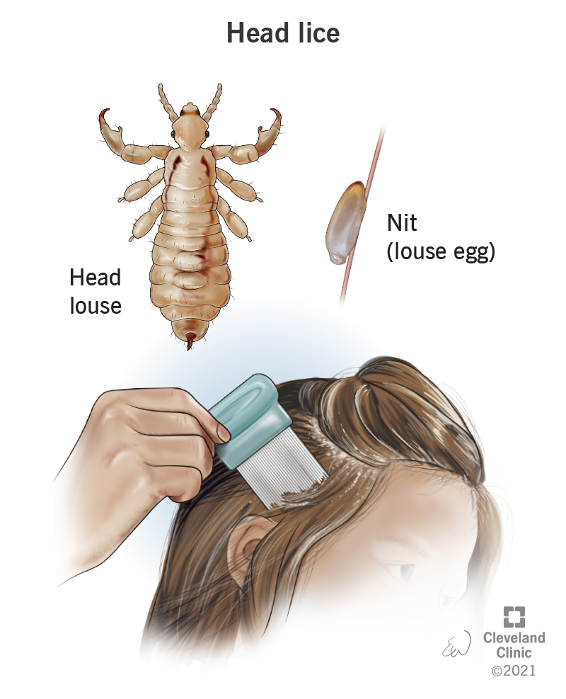 human louse hair