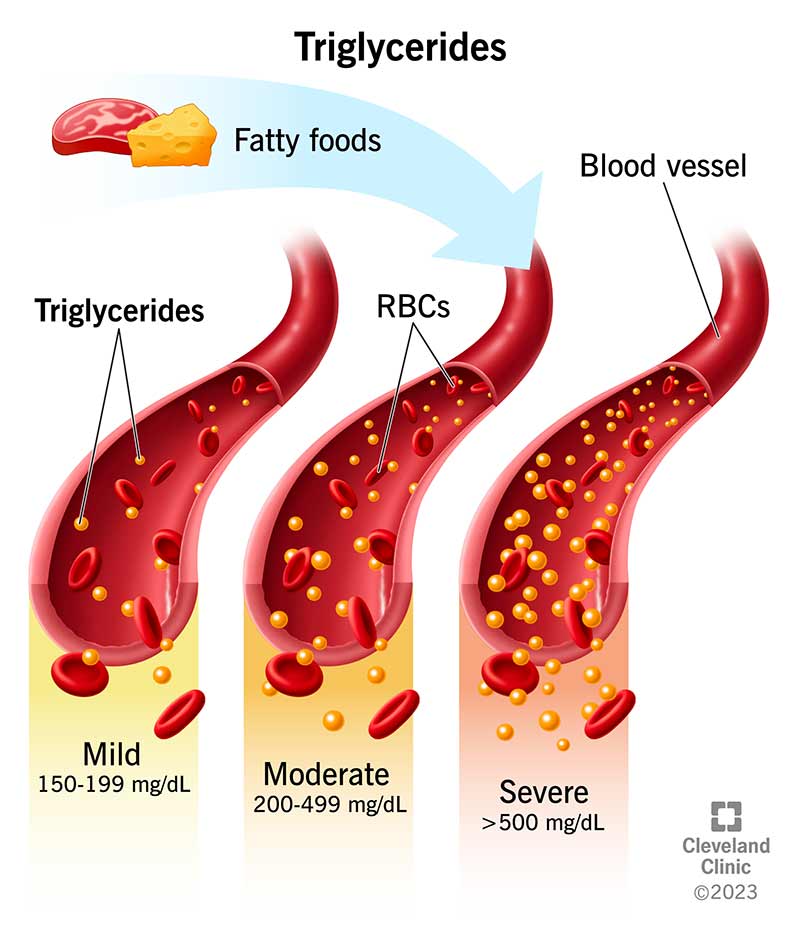 Triglycerides Levels Normal Range