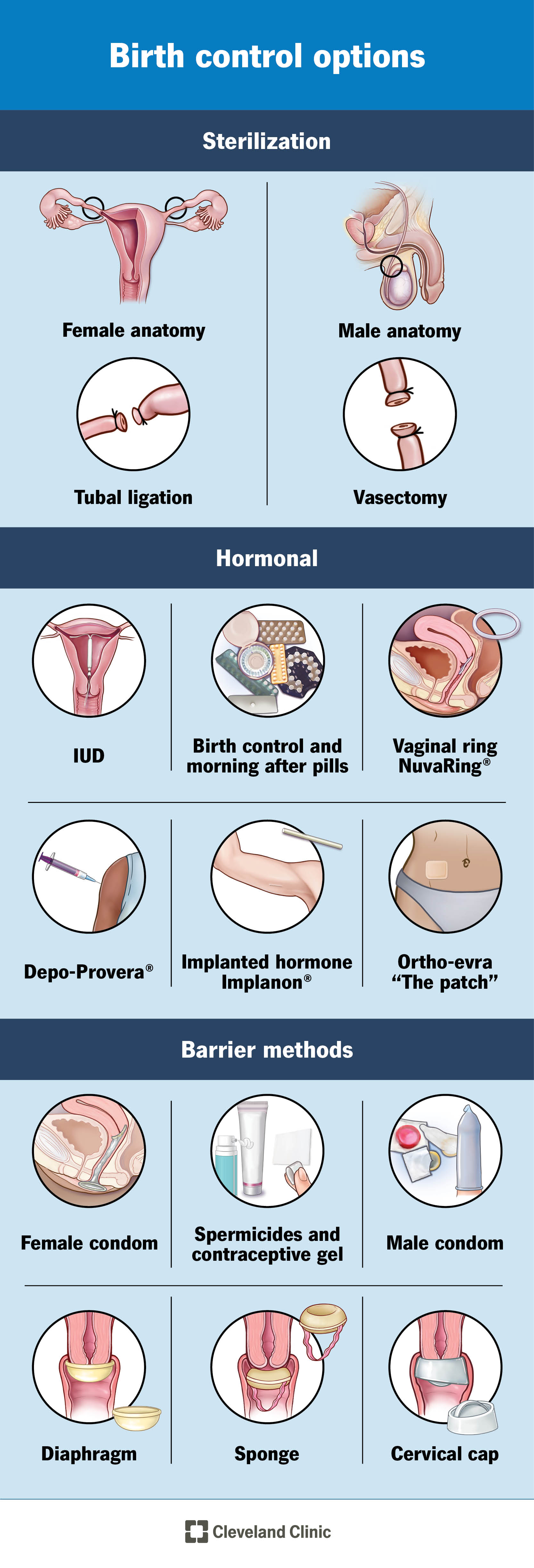 Chart of all the different types of birth control options including hormonal and nonhormonal types. Each type is shown on or in a person's body.