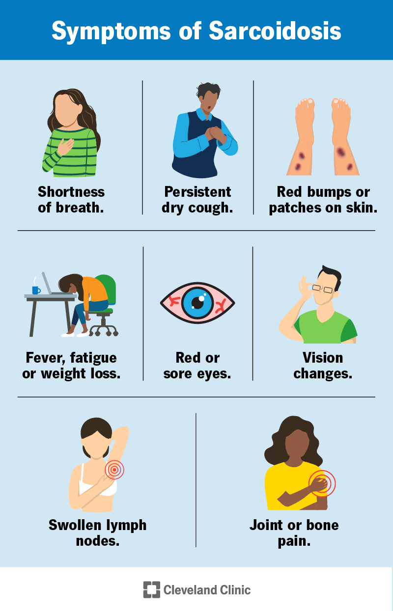 Sarcoidosis symptoms include shortness of breath, dry cough, red bumps, fever, fatigue, weight loss, and red or sore eyes.