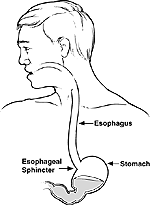 Ösophagus-PH-Test