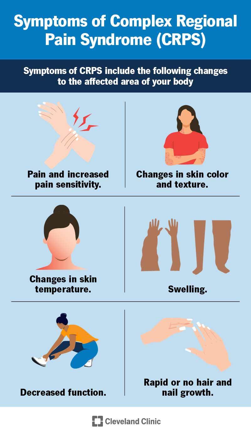 Symptoms of CRPS include changes to one part of your body: pain, skin discoloration, swelling, decreased function and more.