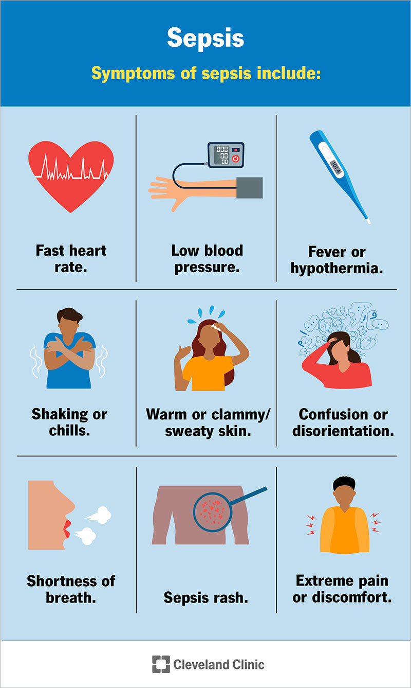 Nine symptoms of sepsis that require immediate medical attention.