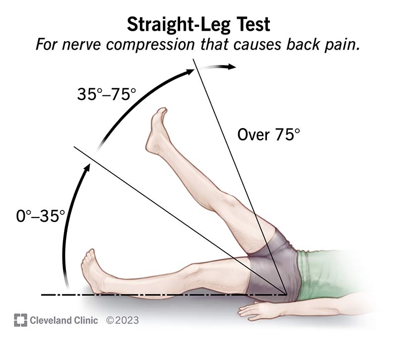 The straight-leg test is common for diagnosing back problems. The point where pain starts is what providers look for.