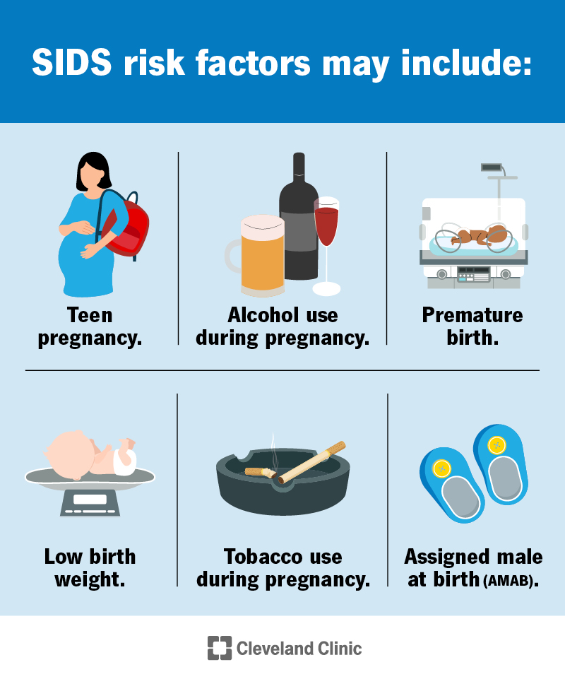 Prevent Sids