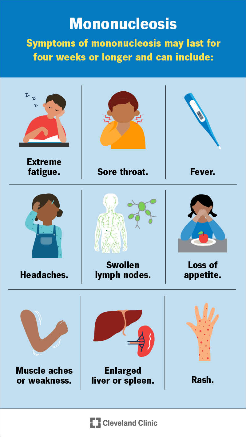 Symptoms of mononucleosis vary, ranging from headaches to swollen lymph nodes.