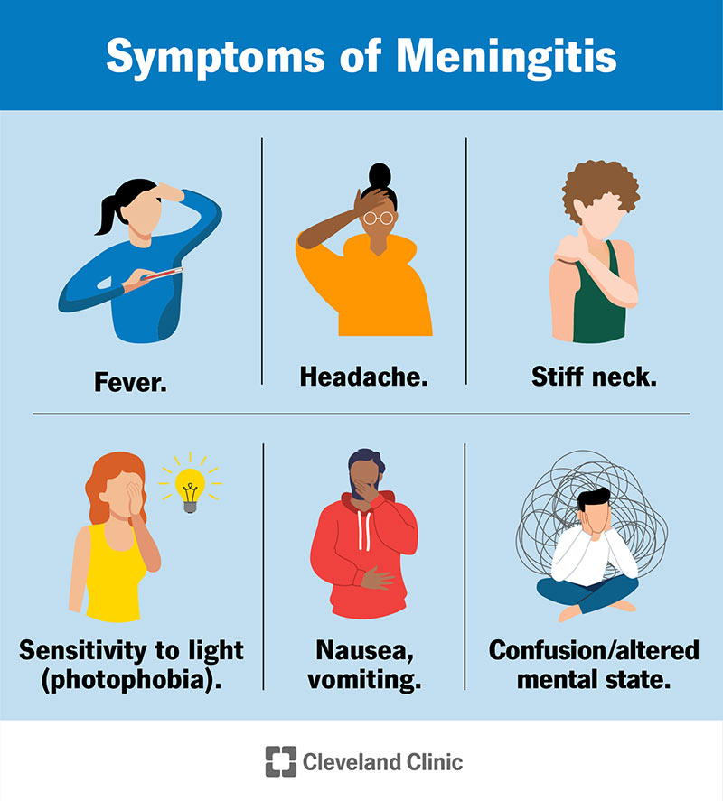 Symptoms of meningitis include fever, headache, neck stiffness, sensitivity to light, nausea, vomiting and confusion.