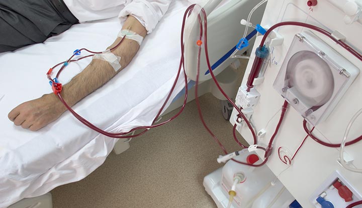 photo of patient undergoing dialysis