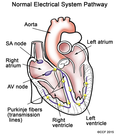 The normal electrical system pathway pushes blood through the heart and out to the rest of the body.