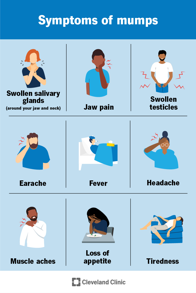 Mumps symptoms include swollen salivary glands, jaw pain, earache, fever, headache, muscle aches, appetite loss and fatigue
