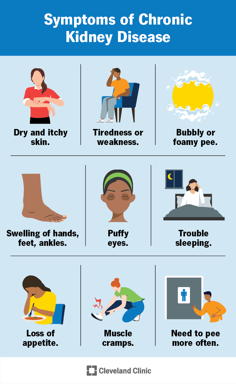 Nine symptoms of chronic kidney disease illustrated on a chart.