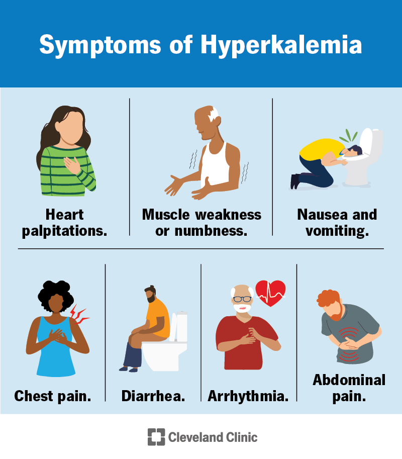 Hypokalemia: Symptoms, Causes, Treatment, And More, 47% OFF