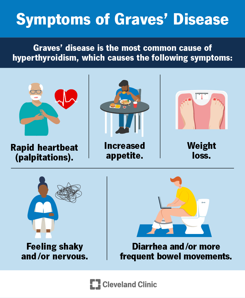 Symptoms of Graves' disease include rapid heartbeat, increased appetite, weight loss, feeling shaking or nervous, and more.