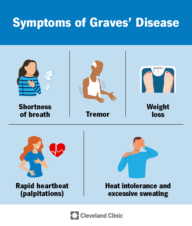 Symptoms And Diagnosis Of Graves Disease Ask The Nurse Expert