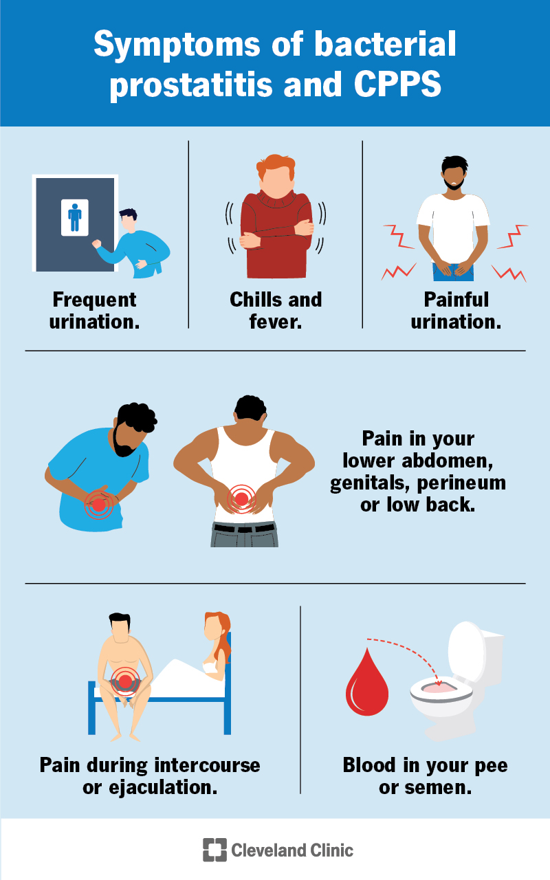 Prostatitis Causes Symptoms Diagnosis Treatment