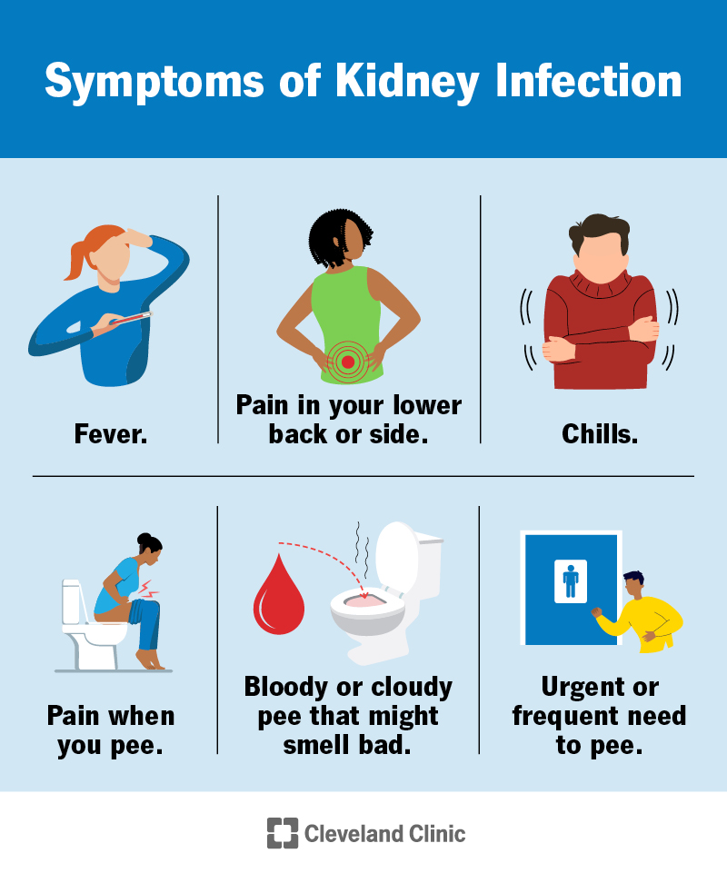 Symptoms of a kidney infection include fever, chills and pain in your lower back. Peeing may be painful, bloody or cloudy.