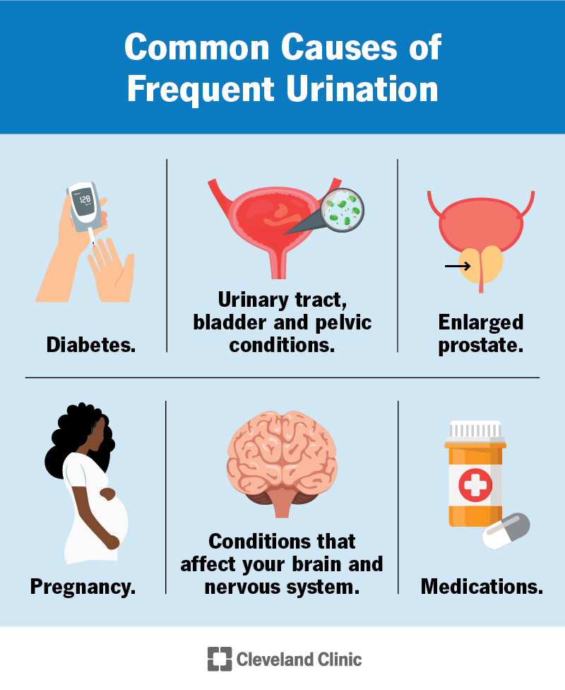 Common causes of frequent urination include: diabetes, pregnancy, enlarged prostate, urinary and bladder conditions and more.