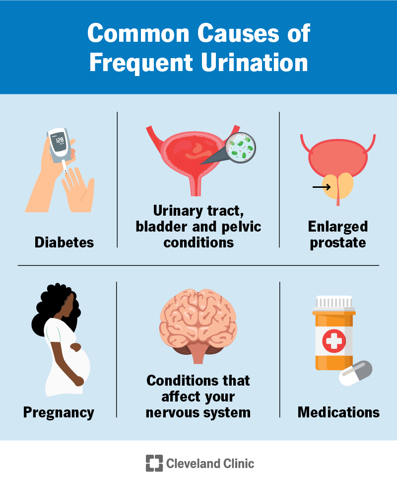 Common causes of frequent urination include: diabetes, pregnancy, enlarged prostate, urinary and bladder conditions and more.