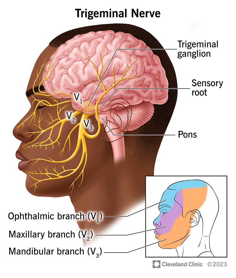 Side view of a face showing the trigeminal ganglion in the brain and areas the three branches (ophthalmic, maxillary and mandibular) cover.