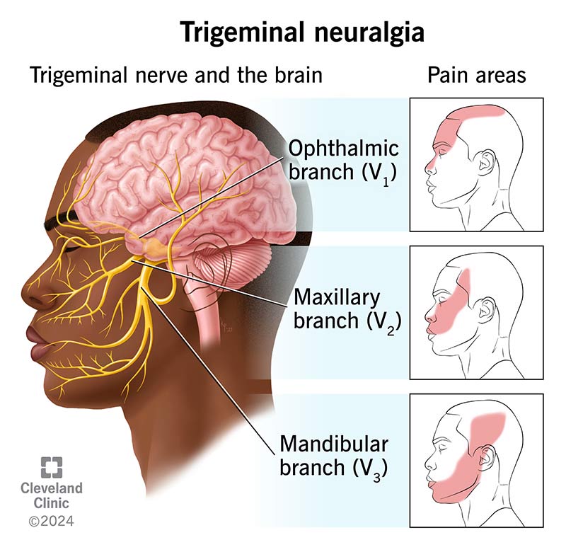 trigeminal nerve pathway