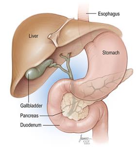 Pancreatic Cancer Symptoms Causes Treatments