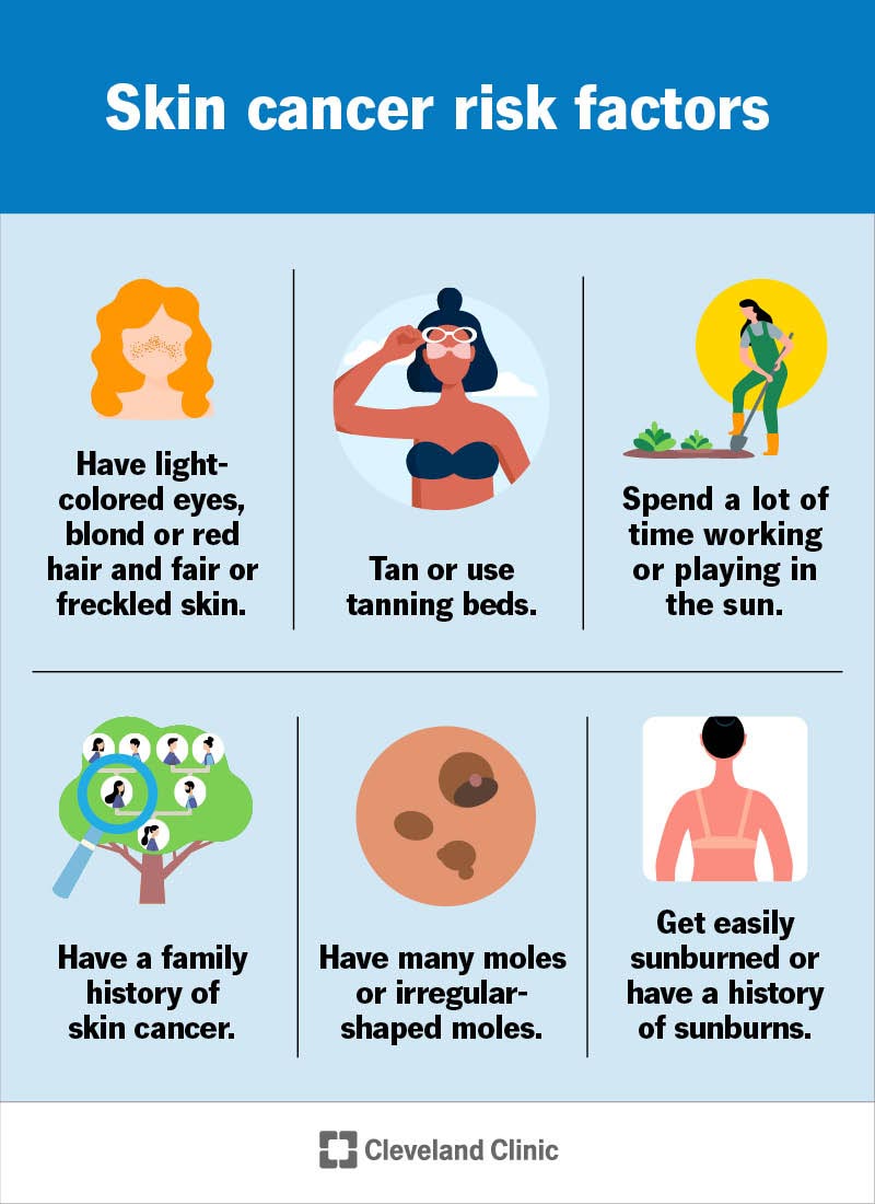 symptoms of skin cancer on black people