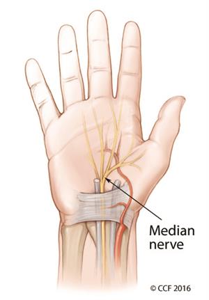 Median Nerve - Median Nerve what does it do? What does it look like?