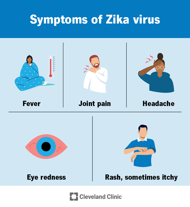 Symptoms of Zika virus infection include fever, joint pain, headache, eye redness and rash, which is sometimes itchy