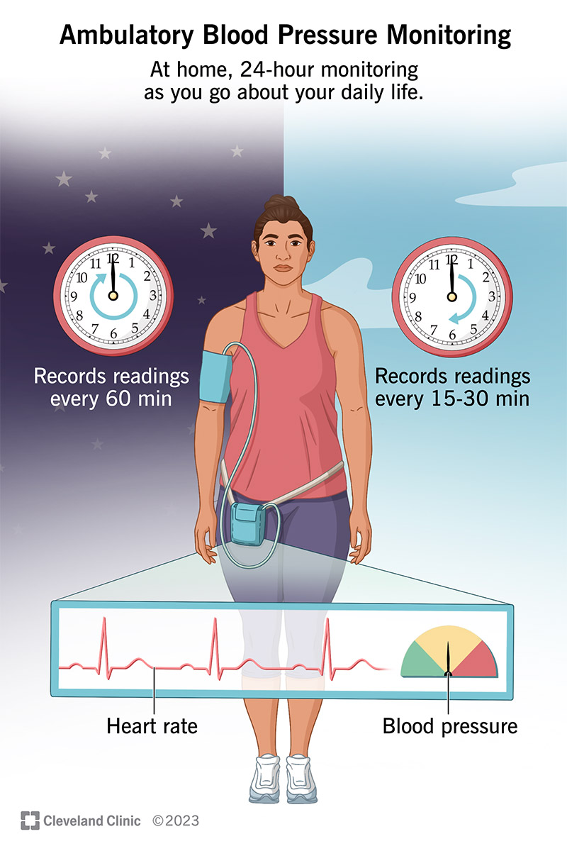 Illustration of a person wearing an ambulatory blood pressure monitor. Behind them, two contrasting images of a nighttime sky and daytime sky show how the device captures readings more often during the day than at night.