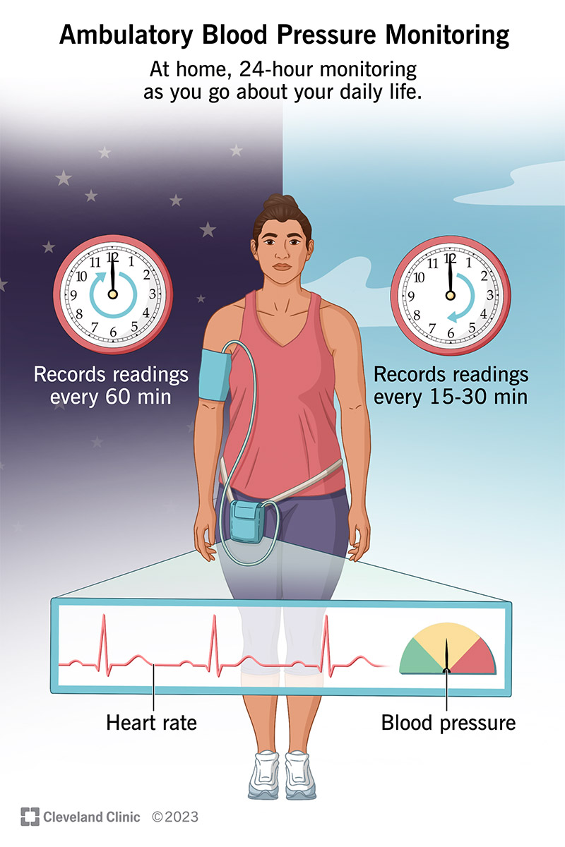 24-Hour Ambulatory Blood Pressure Monitoring