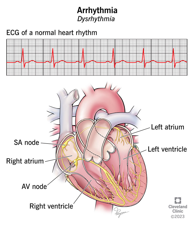 A conduction system handling heartbeat signals. without issues creates a normal ECG without arrhythmia.