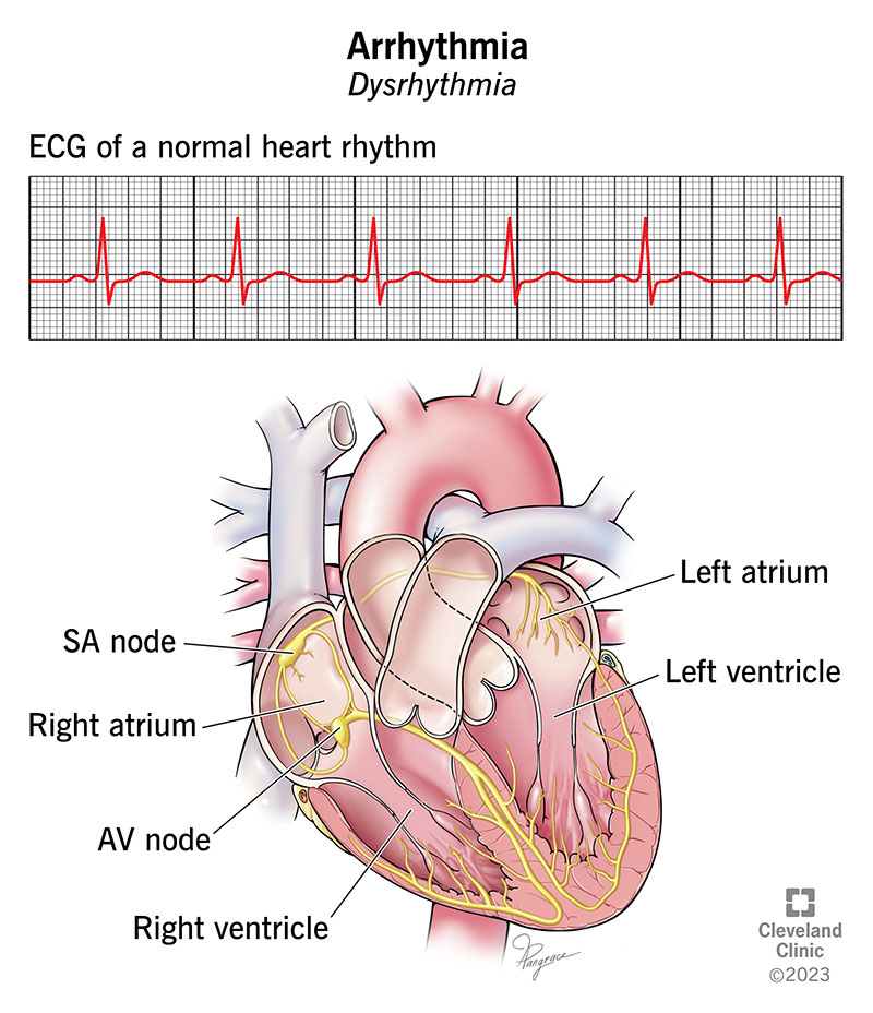 What Is a Dangerous Heart Rate?