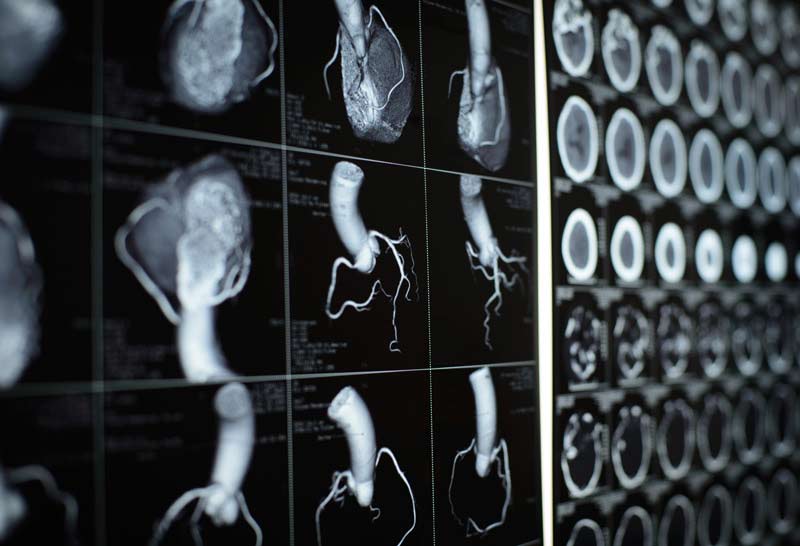 Contrast medium, MRI, CT scan & X-ray