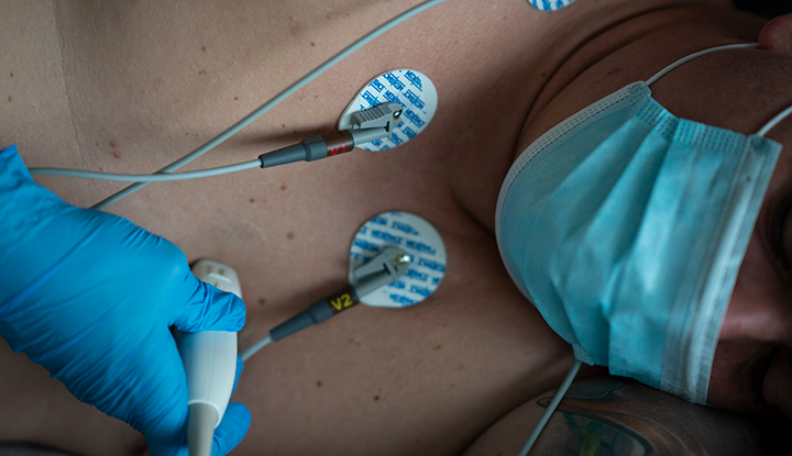 Photograph of a person undergoing a transthoracic echo. They have electrodes on their chest, and their provider is placing a wand on their chest.
