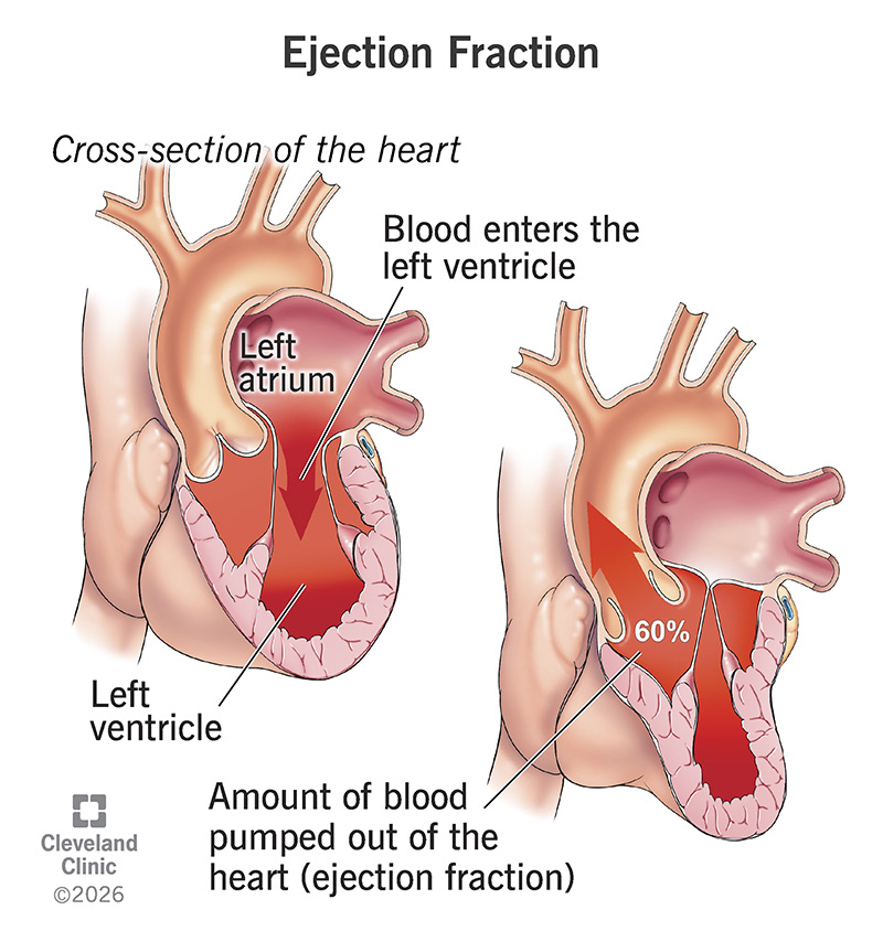 Anatomy of the heart, with ejection fraction, with the heart’s left ventricle pumping out blood