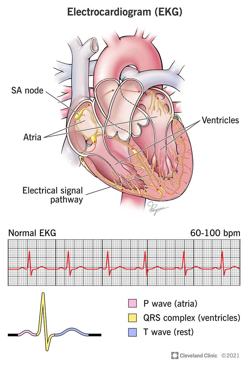 Illustration of how an EKG monitors electrical activity of the heart.