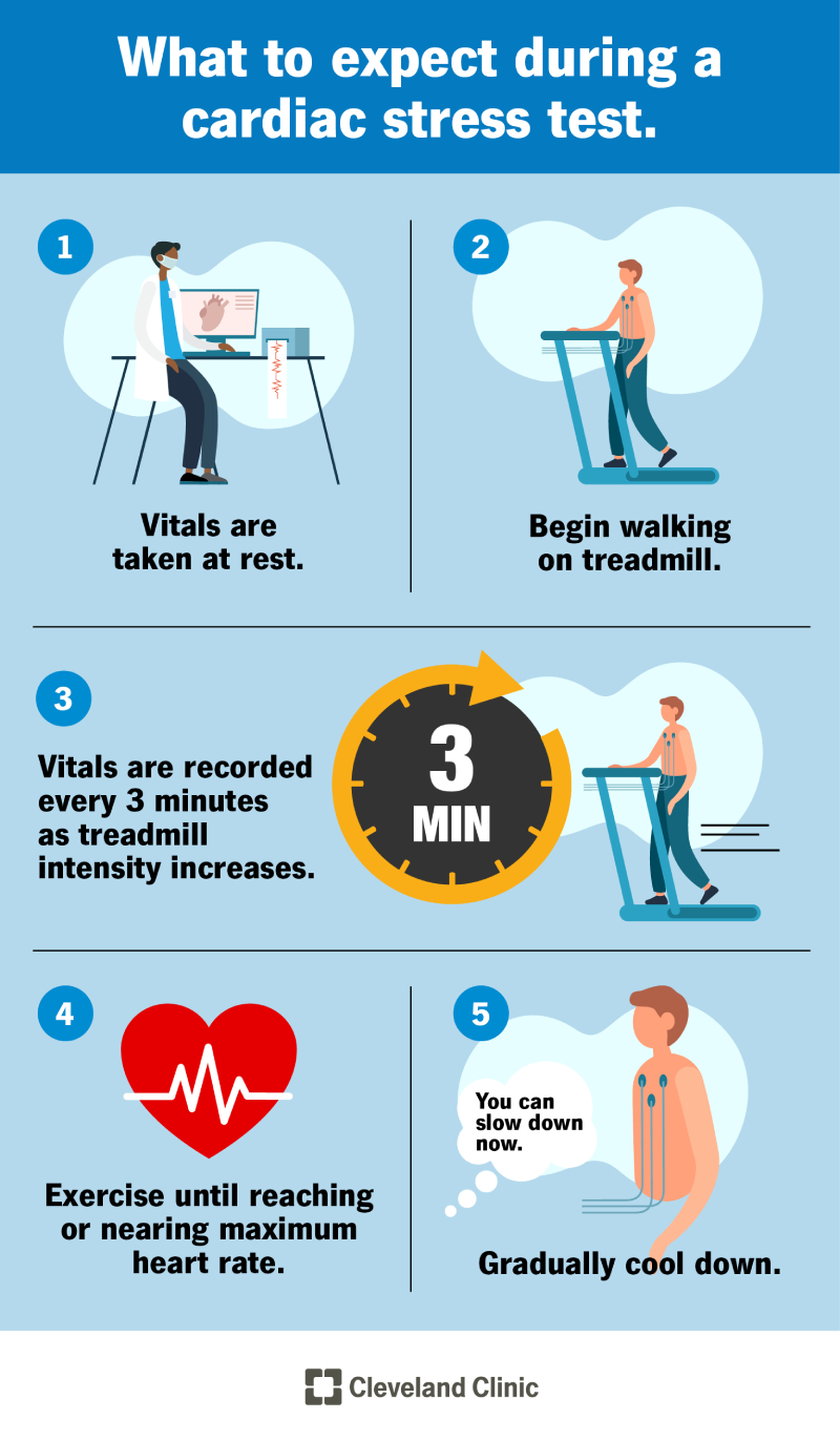 The steps of a cardiac stress test