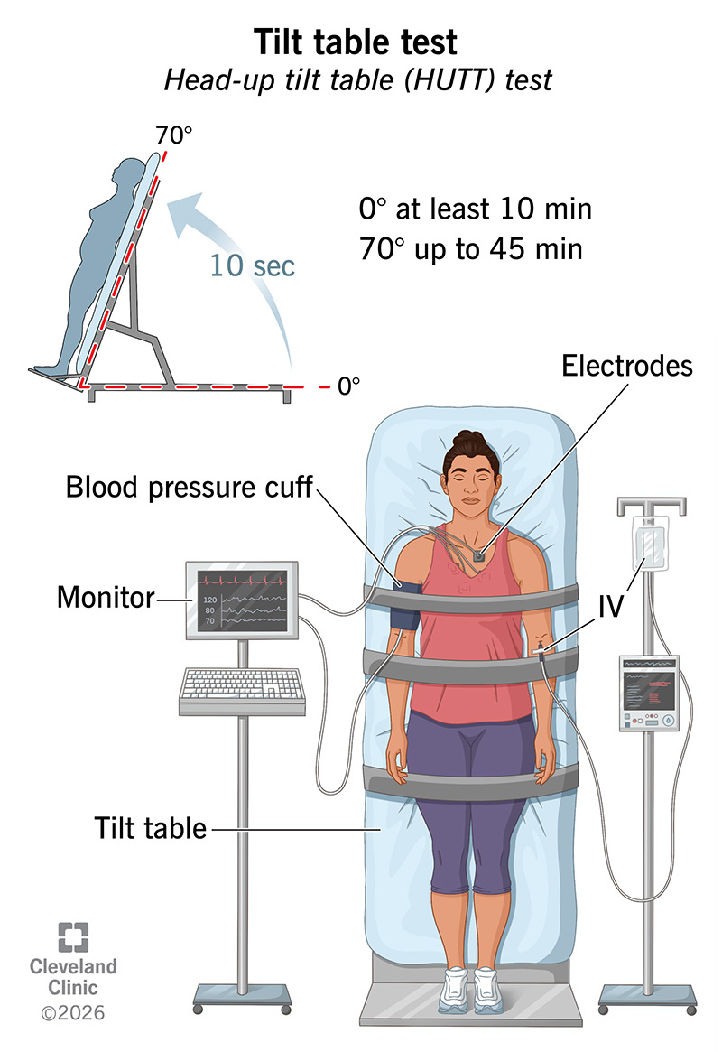 Tilt table test setup, including a table that quickly moves you from a flat to an upright position