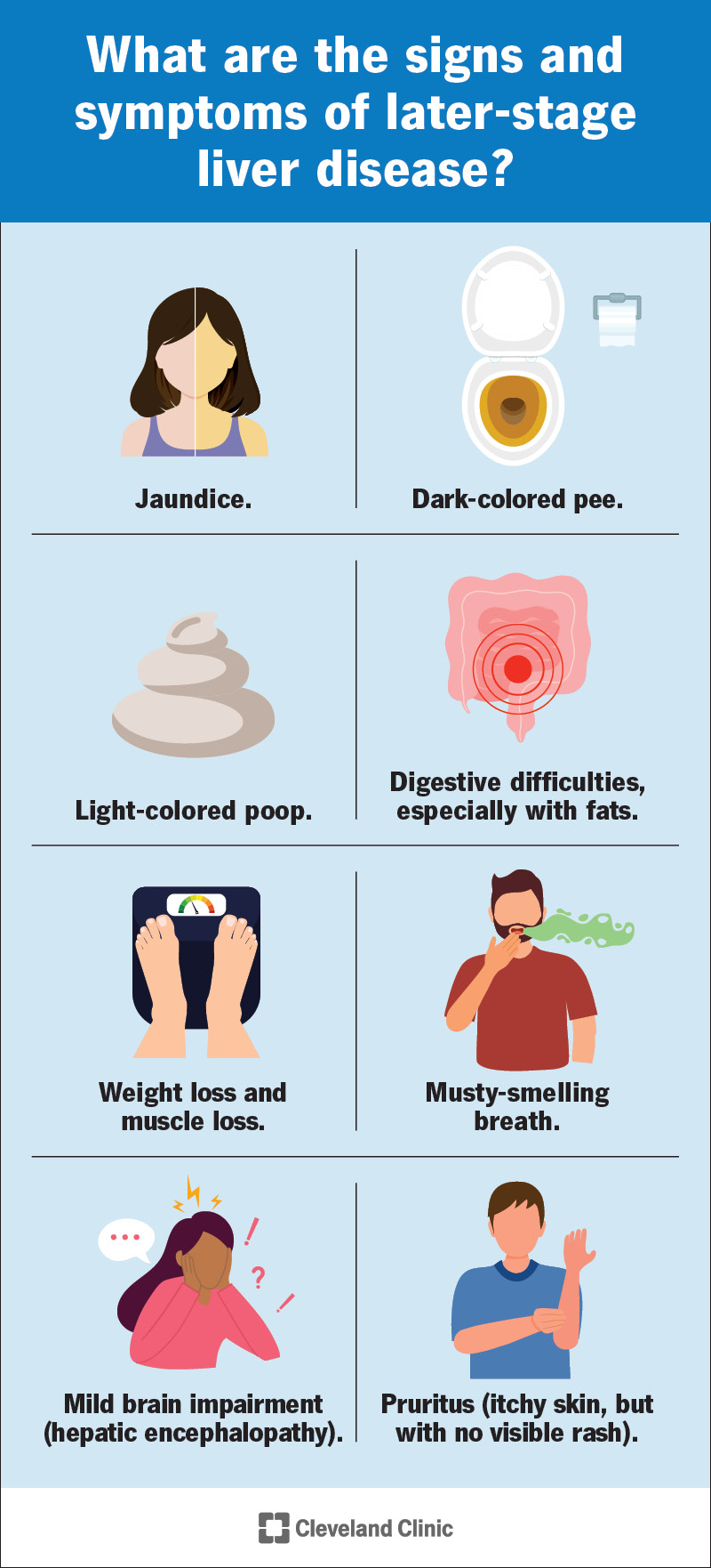 Symptoms of late-stage liver disease include jaundice, itching and mild brain impairment.